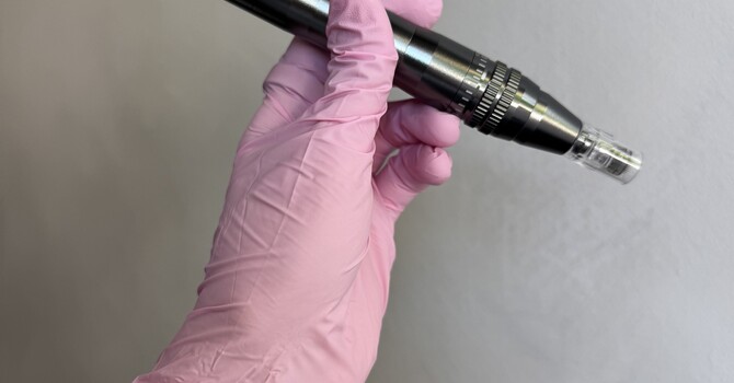 Micro needling with Exosomes  image