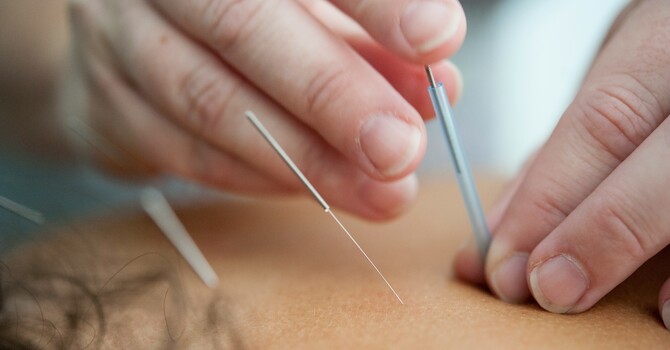 Traditional Chinese Medicine Acupuncture