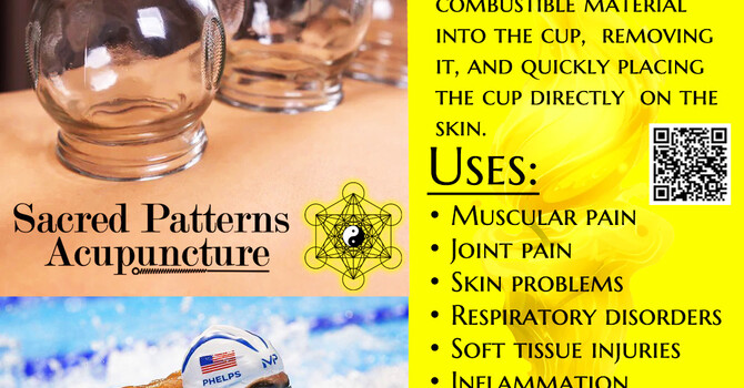 The Health Benefits of Fire Cupping image