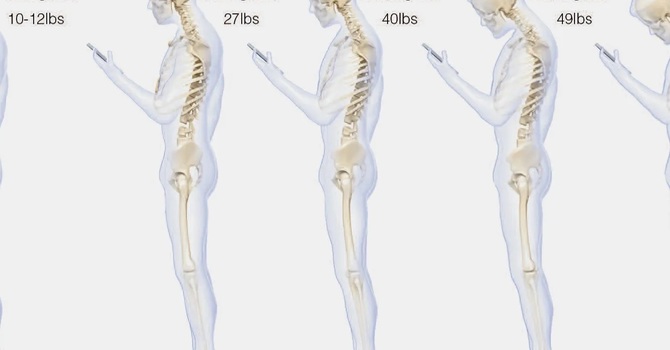 Let's Chat About That Text Neck image