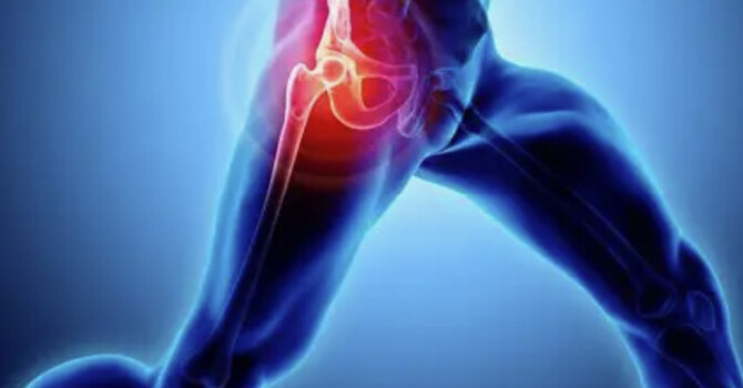 Hip Pain and Sciatica: Causes and Their Connection image