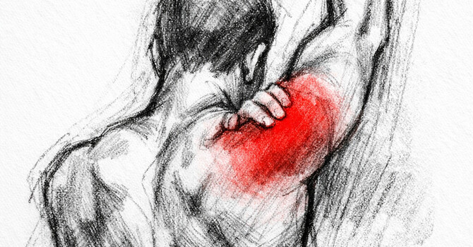 Shoulder Pain When Lifting Your Arm image
