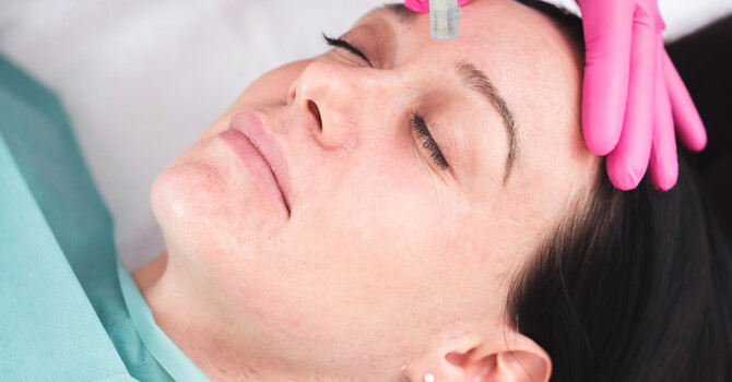 Microneedling Classic