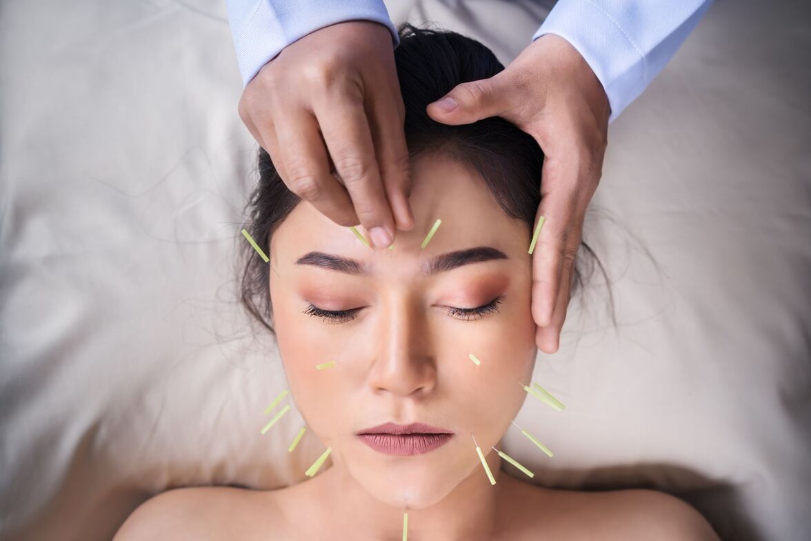 An individual laying down for an acupuncture treatment in Chatham NY, part of a complete guide for first-timers in the Hudson Valley, serving Columbia County and Berkshire County and the surrounding Hudson Valley area