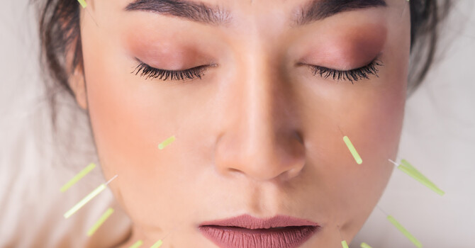Cosmetic Acupuncture & Microneedling