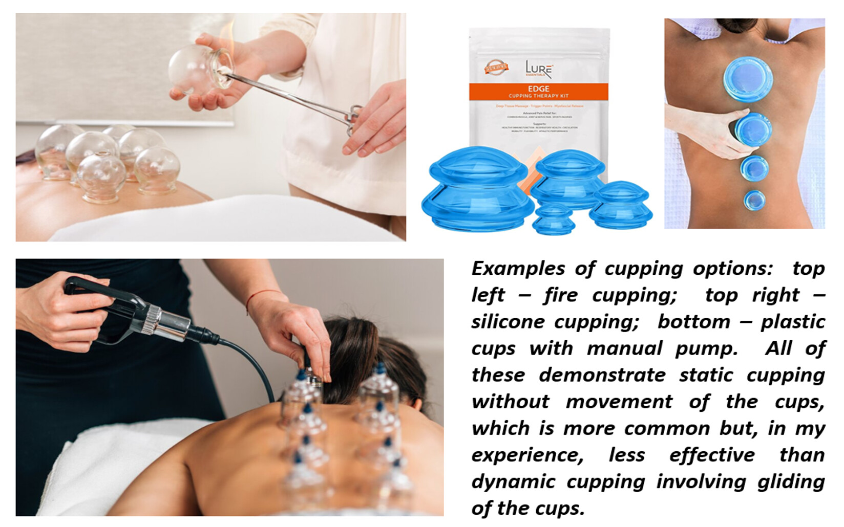 Cupping options