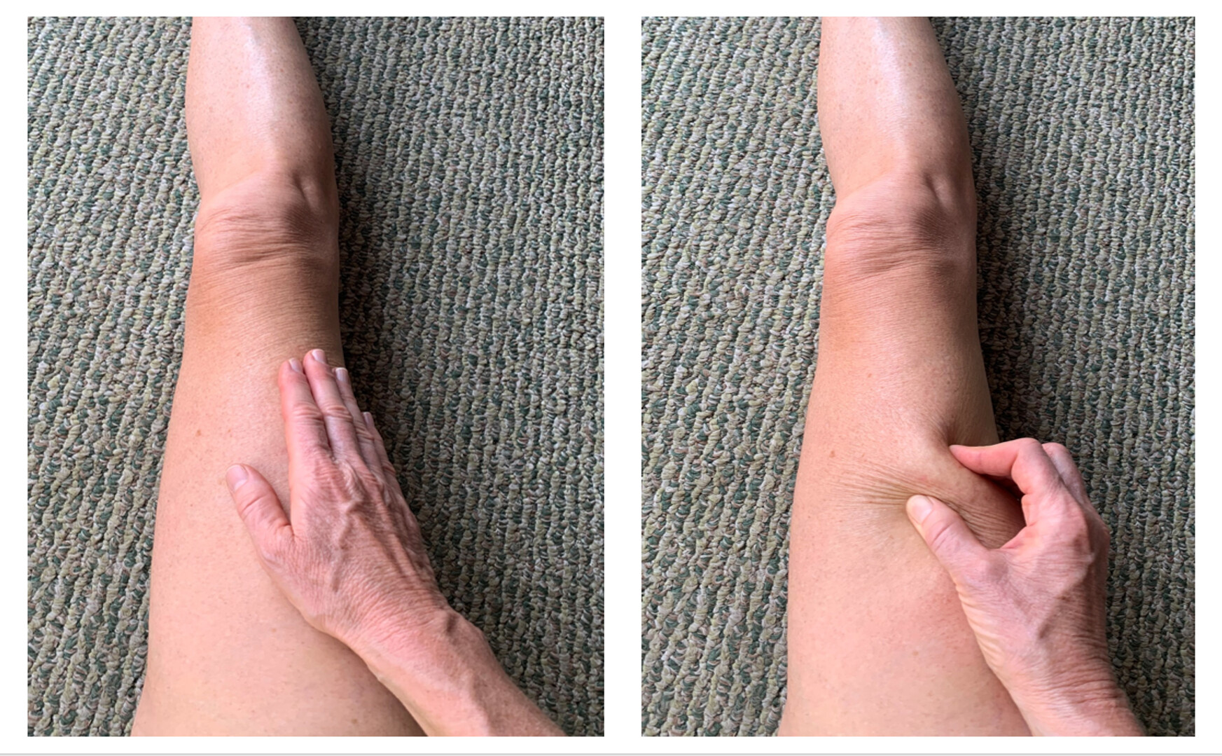 Palpation flat and pincer