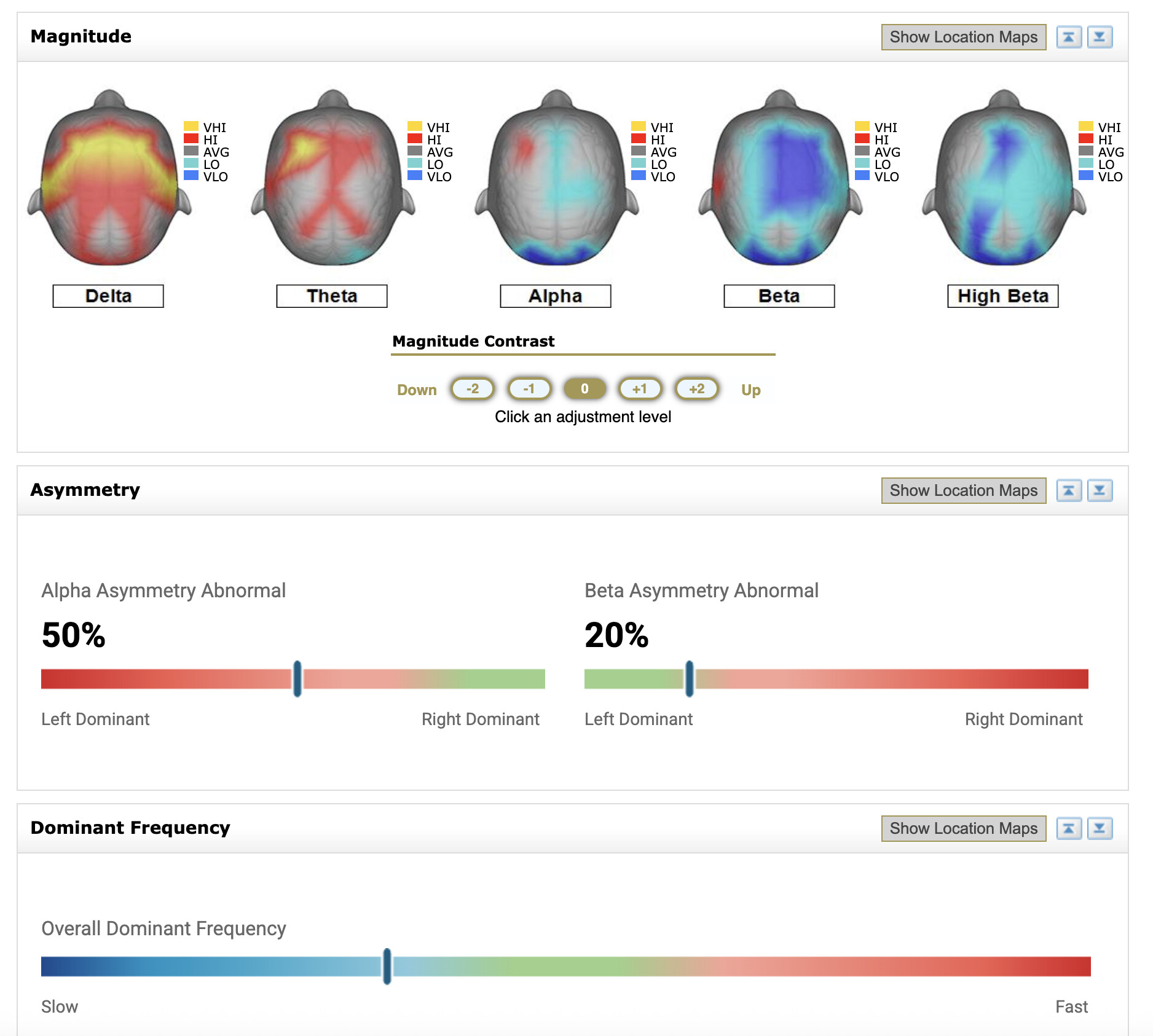 Example of Brain Map