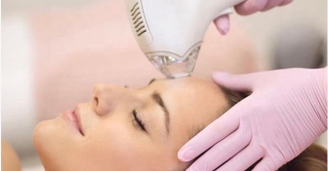 Tixel- Skin Resurfacing- Non-Surgical Bleph