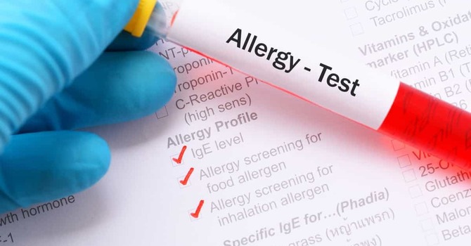 Allergy Services