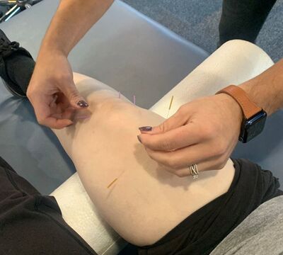 Link to: /pages/dry-needling