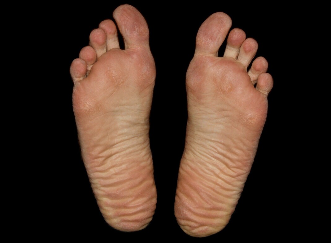 Feet Strengthening