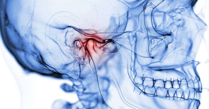 Temporomandibular Disorder (TMD) Jaw Pain