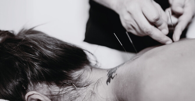 ACUPUNCTURE AT (se)® image