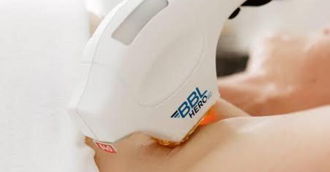 Hair Reduction