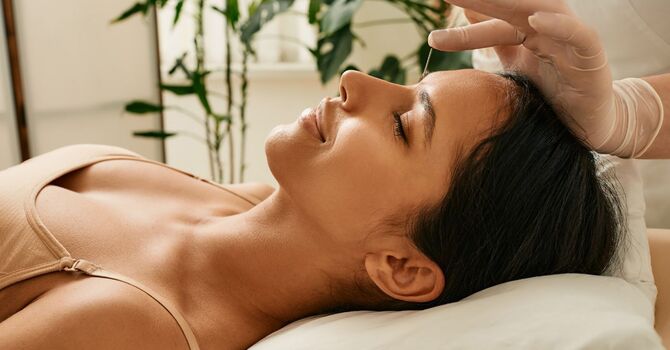 How Acupuncture Helps With Headaches and Why It Works