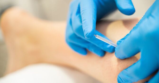 Dry Needling