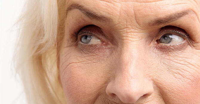 SKIN ELASTICITY