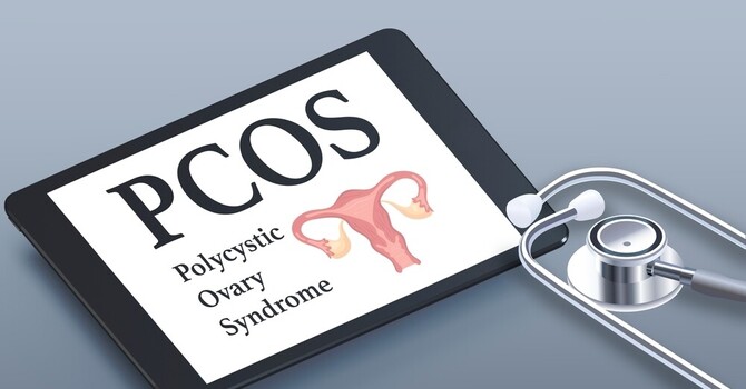 More than just polycystic ovaries image