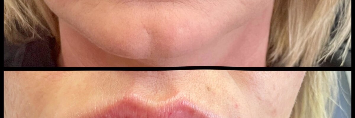 Aesthetic Unfiltered Aurora & Ocelli Aesthetics Terre Haute