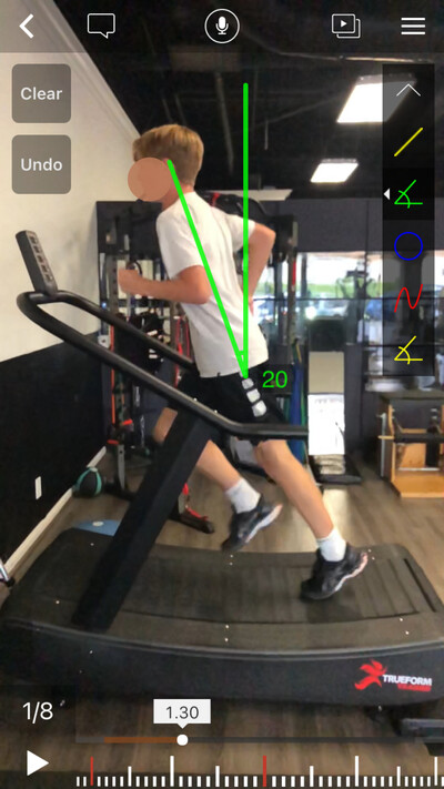 Step 3: TrueForm