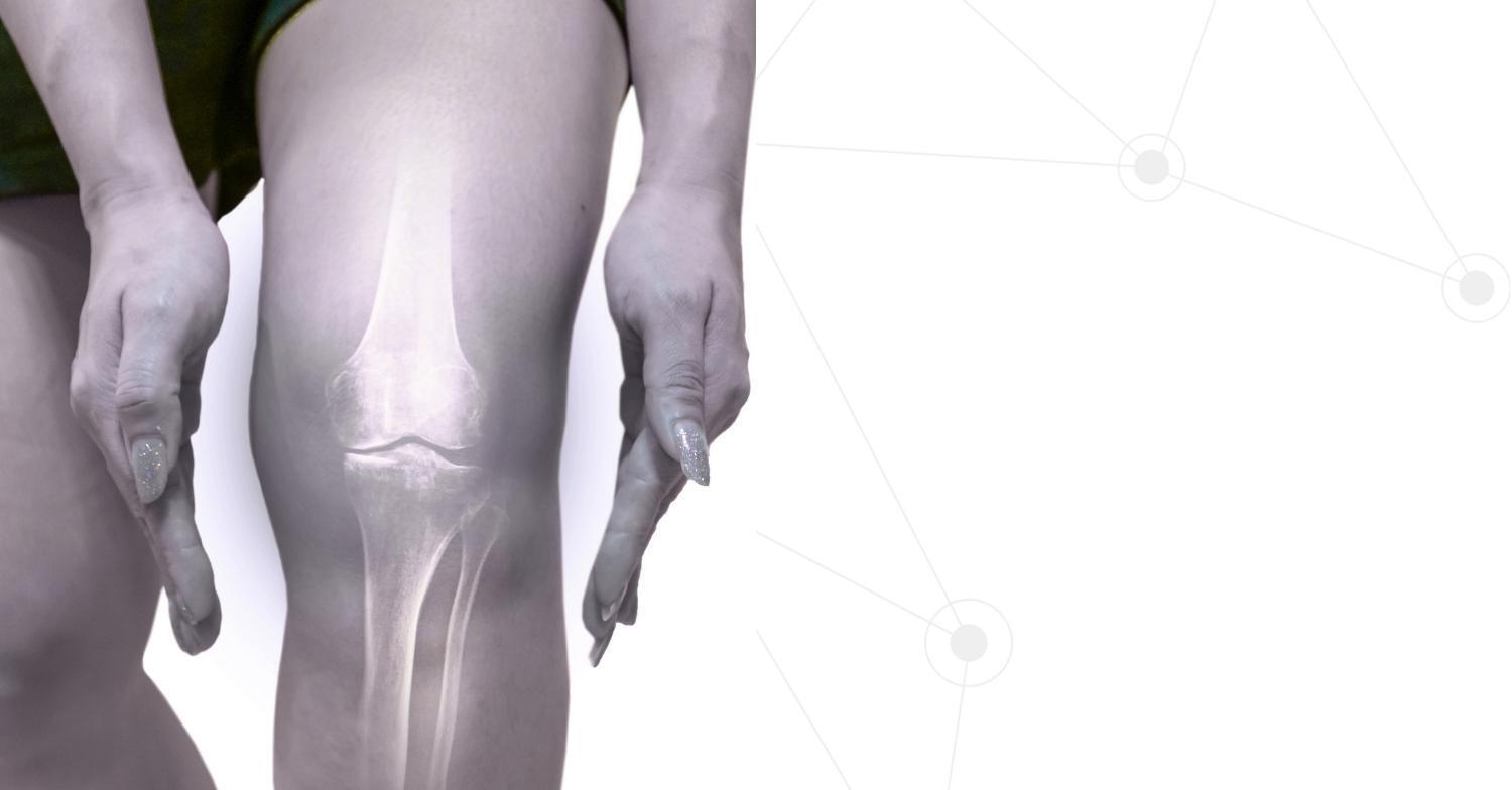 Injection Therapy