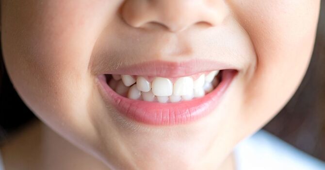 How to Stop Kids from Grinding Teeth: A Myofunctional Therapy Solution image