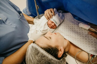 C-section Scar Work