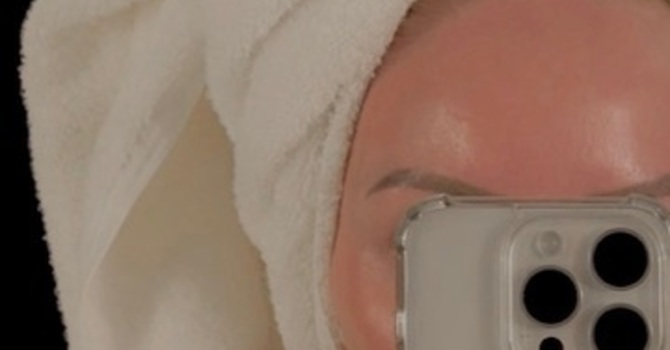 Finding Your Skin’s Perfect Balance