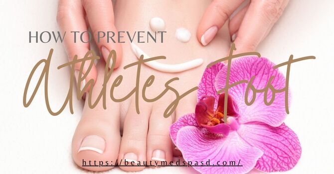 Athlete’s Foot: Symptoms & Solutions