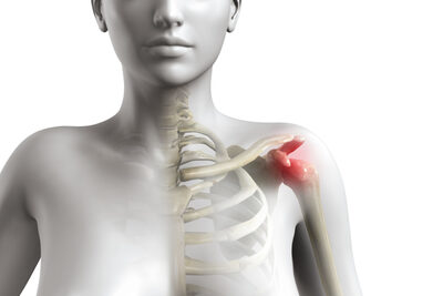 Link to: /programs/shoulder-impingement-physiotherapy-in-toronto