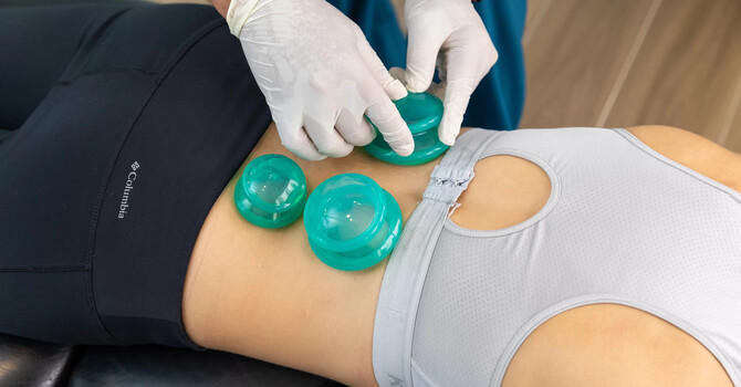 Can Acupuncture Give You More Energy at the Gym?