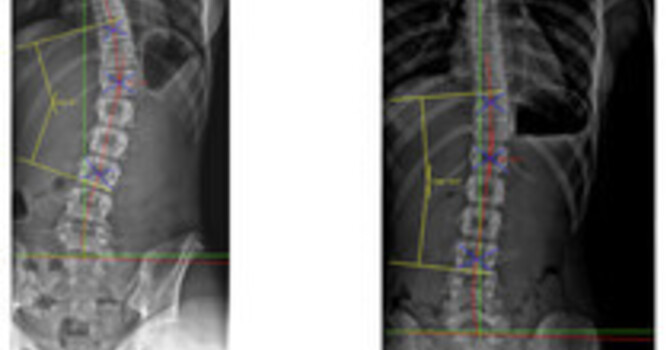 What does a Chiropractor actually do?