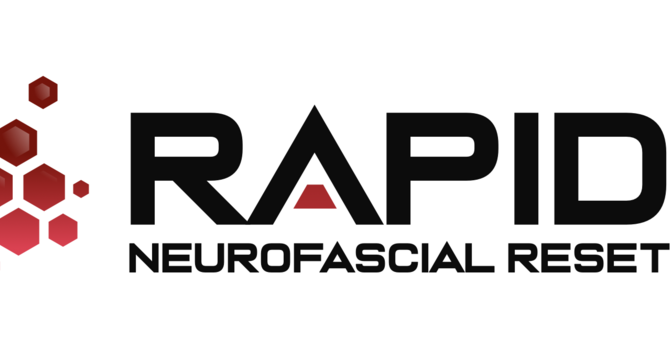 RAPID isn’t about ‘breaking things up’ 