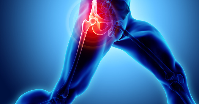 Hip Pain