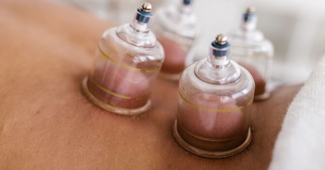 What Are the Benefits of Cupping