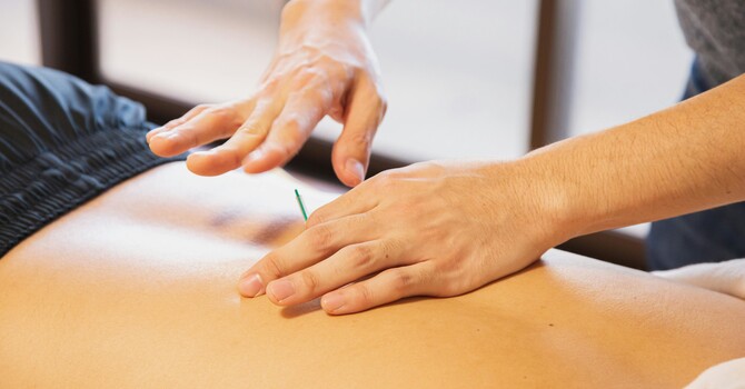Suffering from Chronic Pain? Acupuncture Can Help image