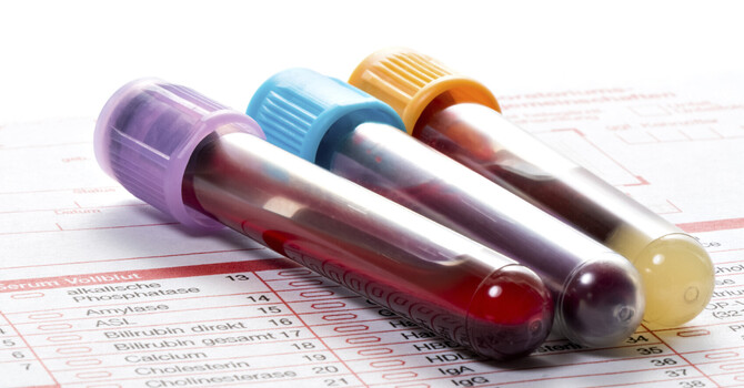 Lab Tests