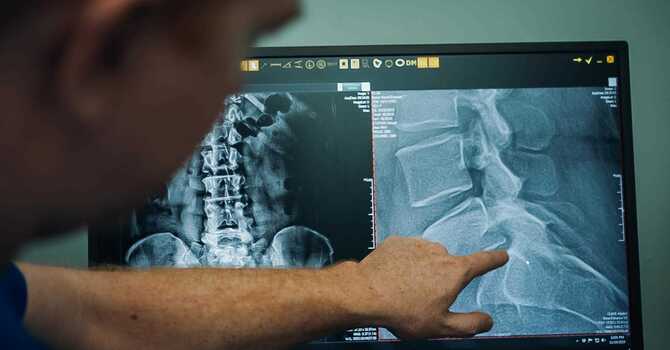 Digital X-Rays