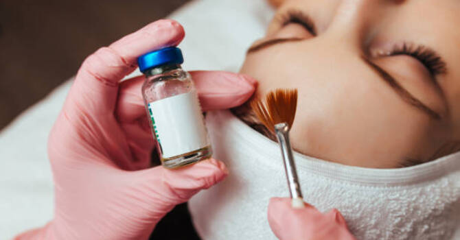 Chemical Peels
