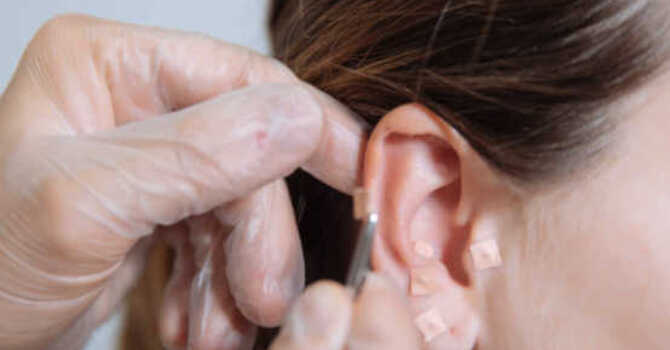 Ear beads