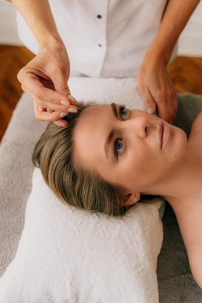 Cosmetic Acupuncture