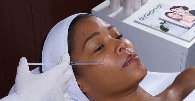 Chemical Peel with EXO-NAD
