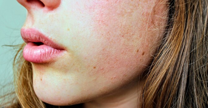 The Hidden Skin Stressors of Modern Life  image