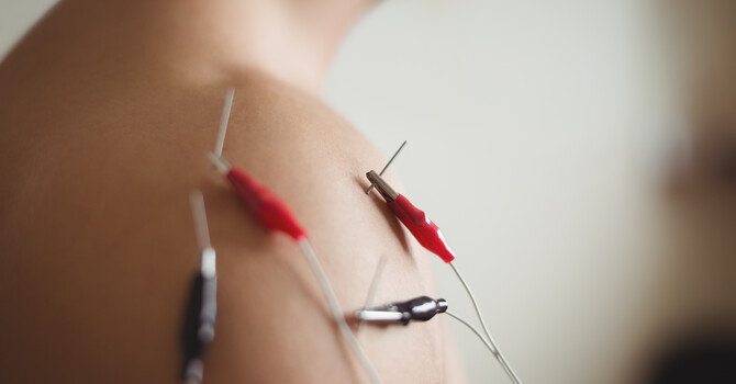 Dry Needling