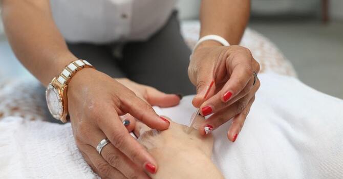 Dry Needling 