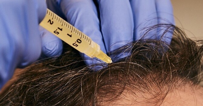 Hair & Scalp