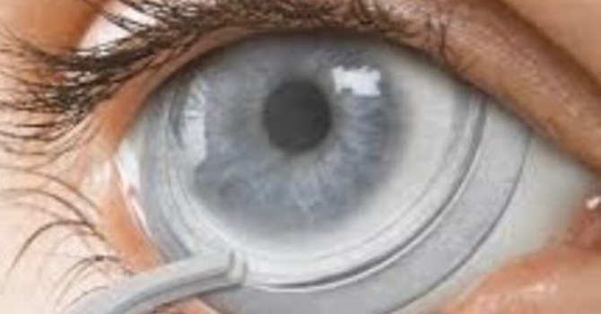 Amniotic Membrane