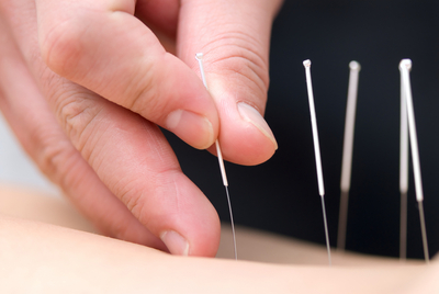 Link to: /pages/acupuncture