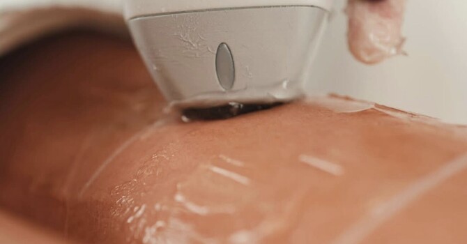 Laser Treatments
